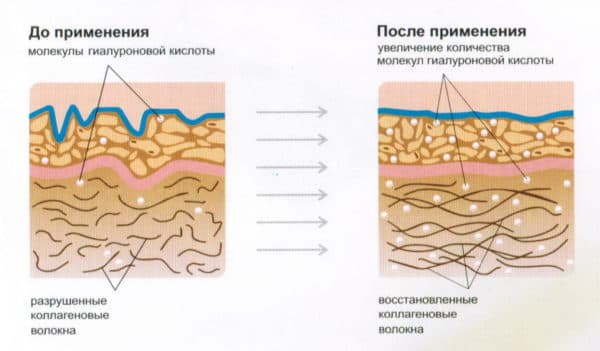 12 золотых масок для лица: отзывы о пленке из Кореи, корейская Wokali Snail Gold Collagen, 24k золотого цвета из Тайланда, как пользоваться