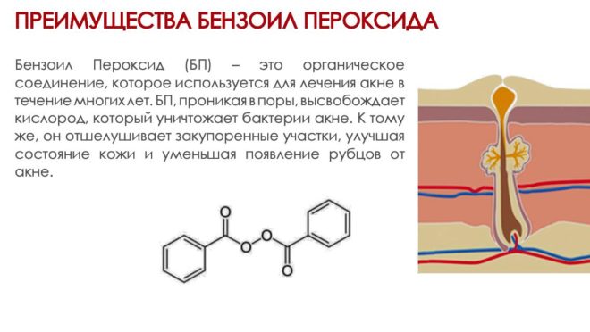 Как бороться с псориазом